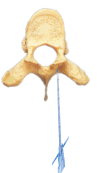 ccparamedian1